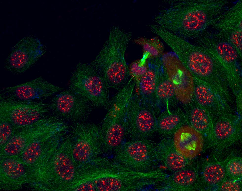Mitotic spindles